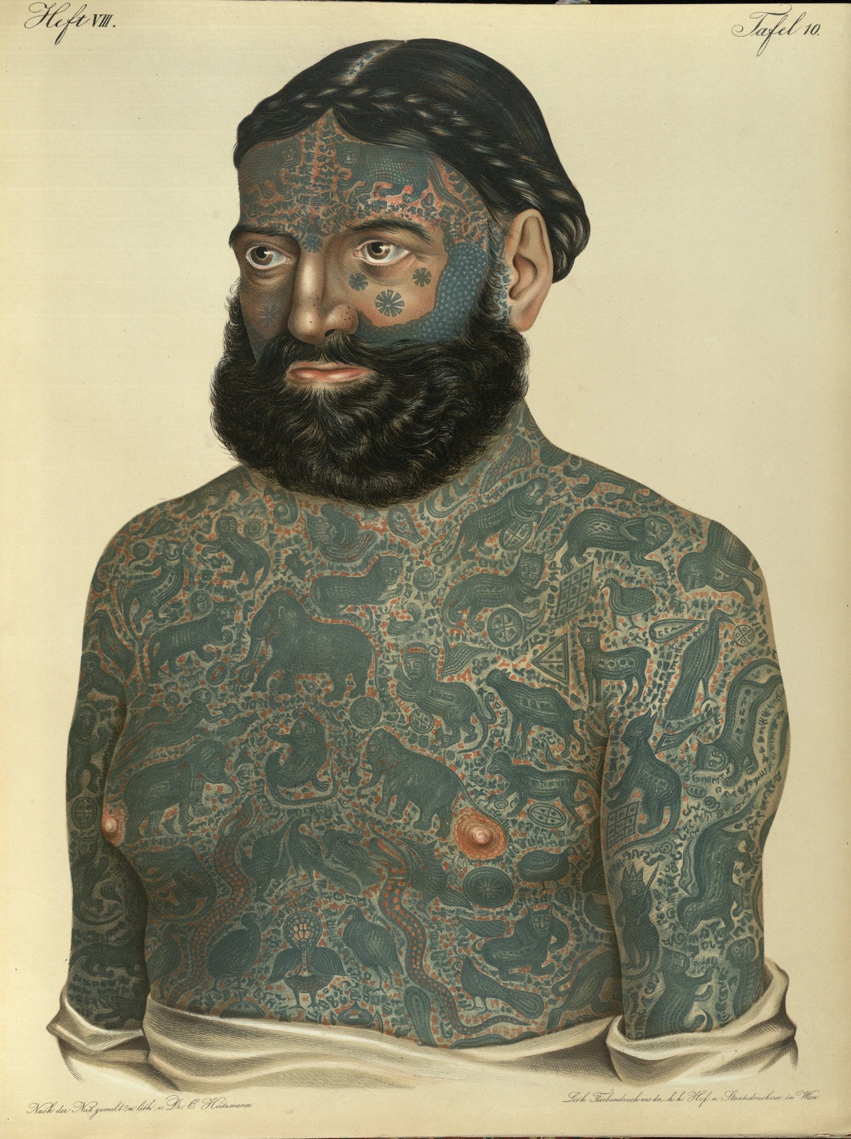 Captain Costentenus featured in the 19th century "Atlas of Skin Diseases", illustrated by two Austrian physicians who were also painters, Dr Anton Elfinger and Dr Carl Heitzmann.